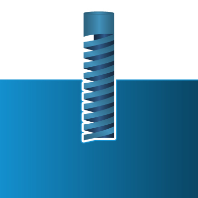 Optimize Tapped Holes Optimize Tapped Holes