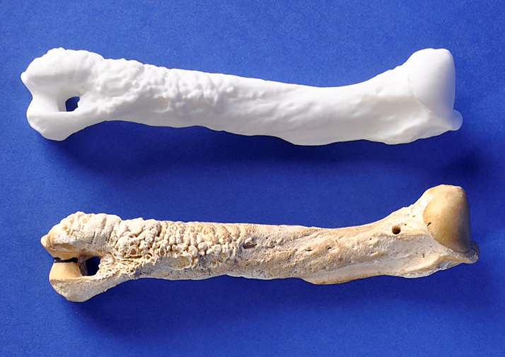 Bones Enhanced